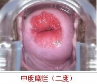 ��������2�������ļҸ���ҽԺ���ƺ�