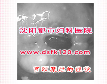 �������õ�֢״